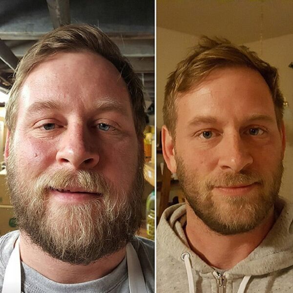 the appearance of a person before and after giving up alcohol